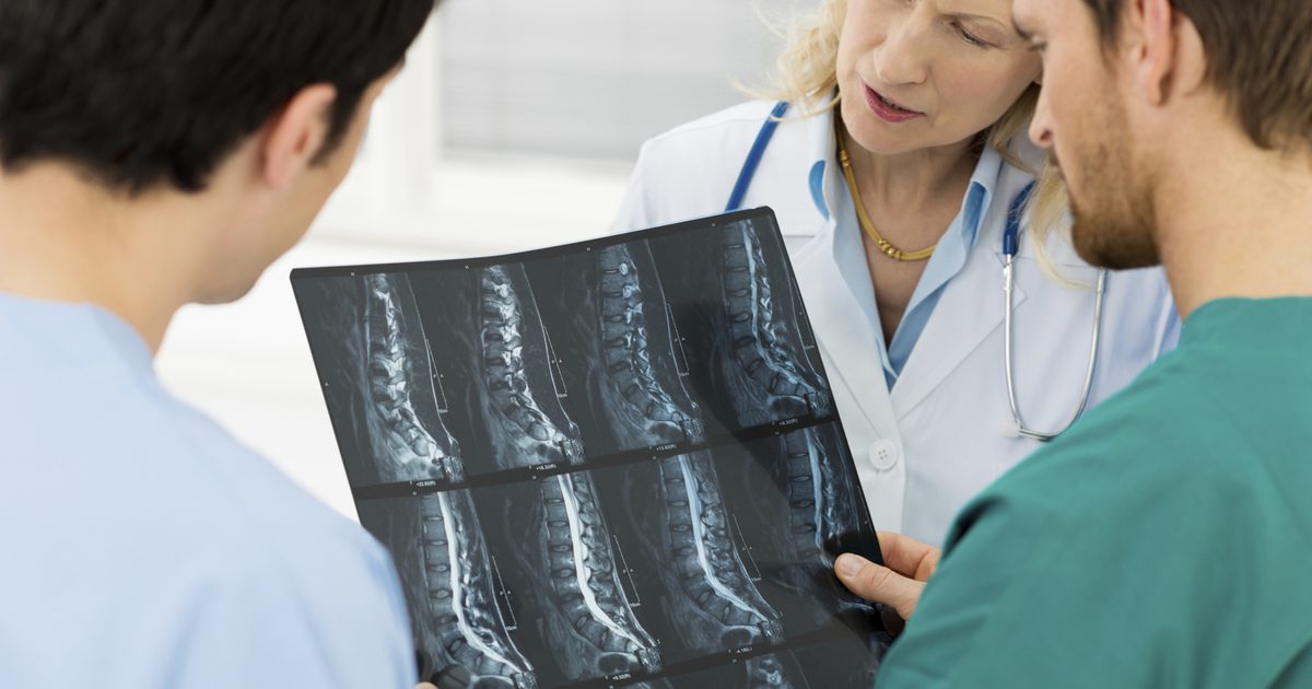 5 stvari, ki jih morate poznati invalidnost hrbtenične stenoze