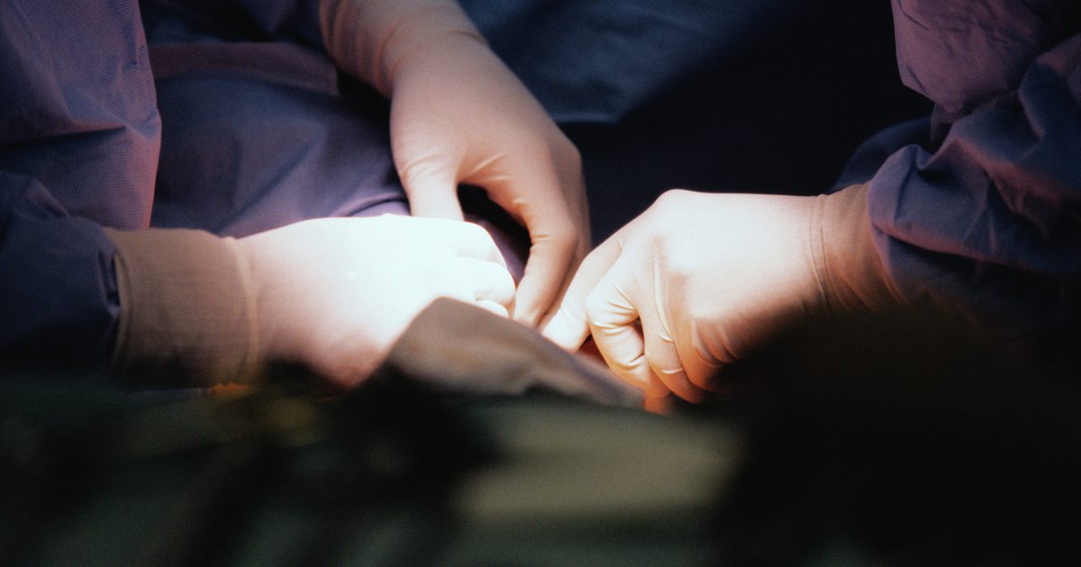 Abdominal kirurgi Postoperative komplikasjoner