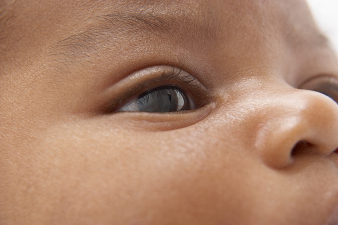 Abnormálne pohyby očí a hlavy u detí