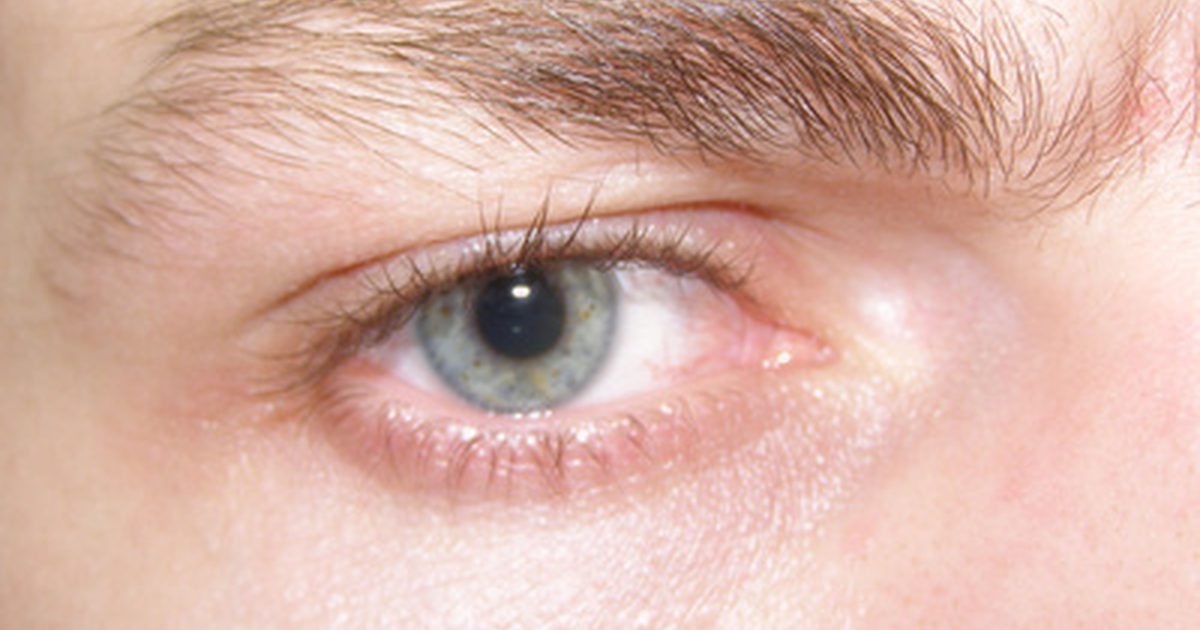ردود الفعل السلبية لفيتامين E قطرات في العين