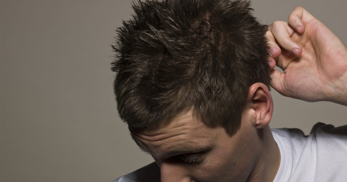 Allergisk reaksjon på hårprodukt: Skallete, tørre utslag på halsen