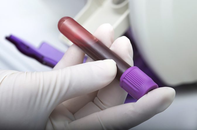Krevní testy, které ukazují rakovinu
