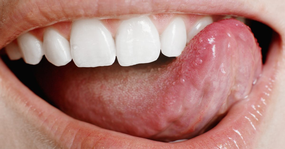 Orsaker till sår på tungan