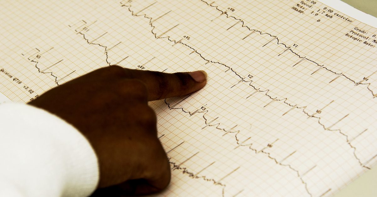Przyczyny nieprawidłowych wyników EKG