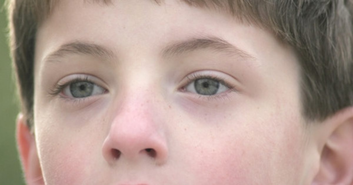 Vzroki krvavih nosov pri otrocih