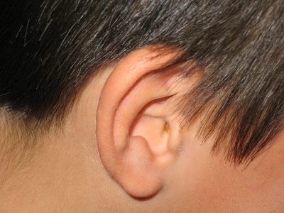 Orsaker till öronsmärta utan infektion