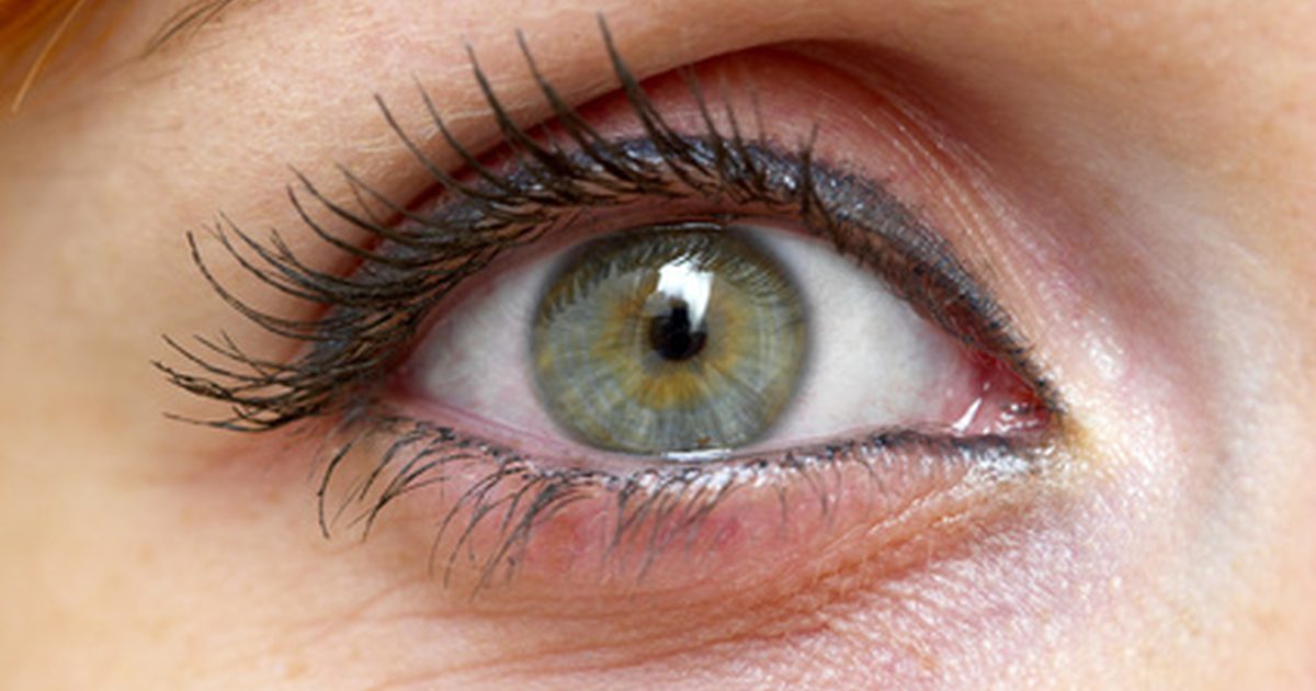 Årsaker til grønt slim i øyet
