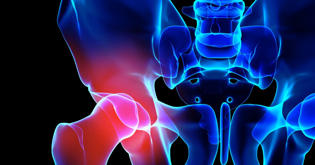 Příčiny bolesti v oblasti bedra a kostí