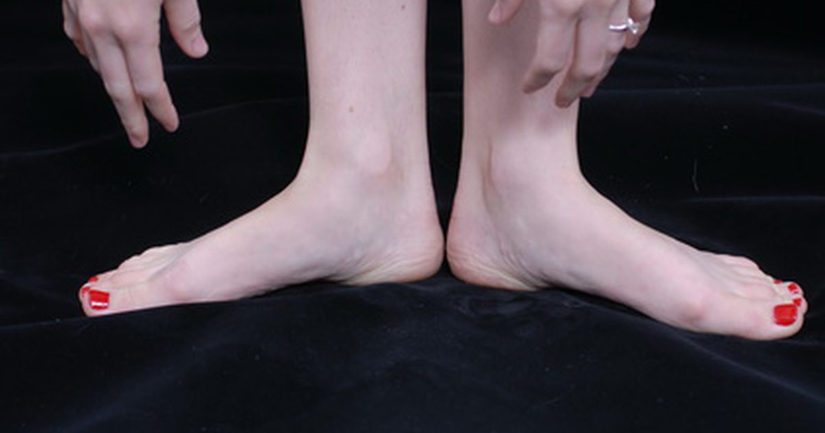 Причини за лоша циркулация в краката и ръцете