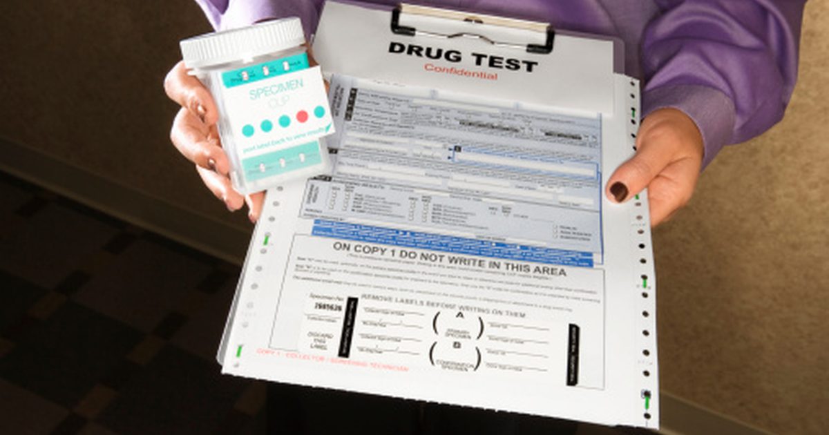 Dejstva o marihuani v testu urina