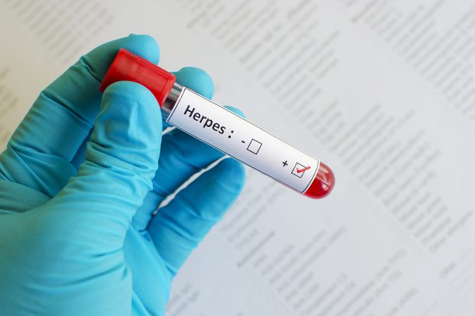 Herpes vedľajšie účinky
