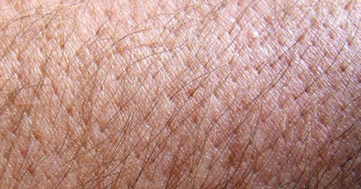 Как кожа предотвращает болезнь?