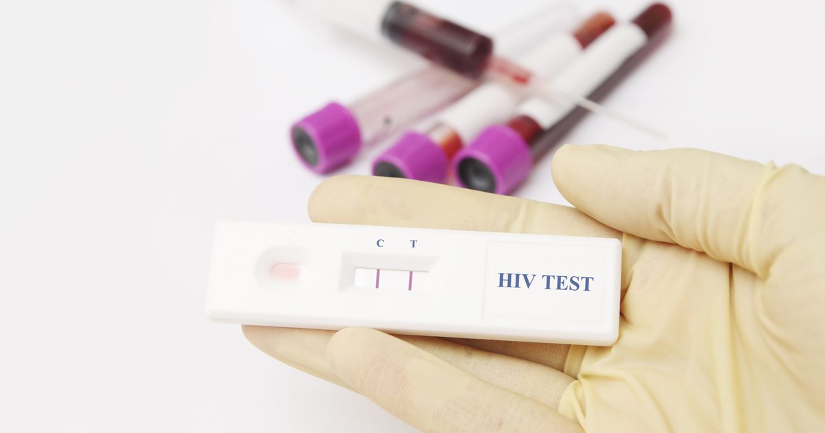 Wie wird ein STD-Test durchgeführt?