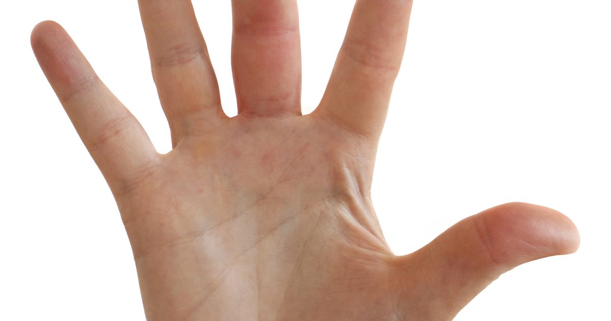 Hoe zwelling in de vingers te verminderen na een dierlijke bijt infectie