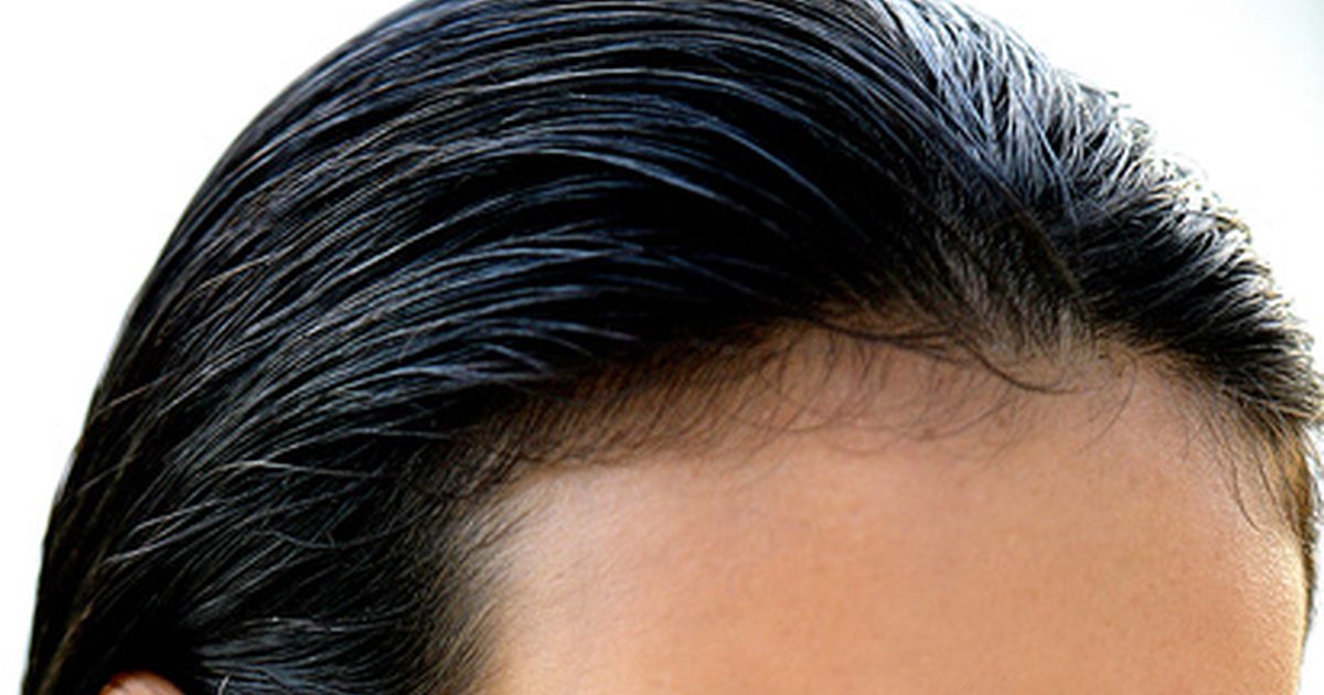 Hur man regrow hår på en receding hairline