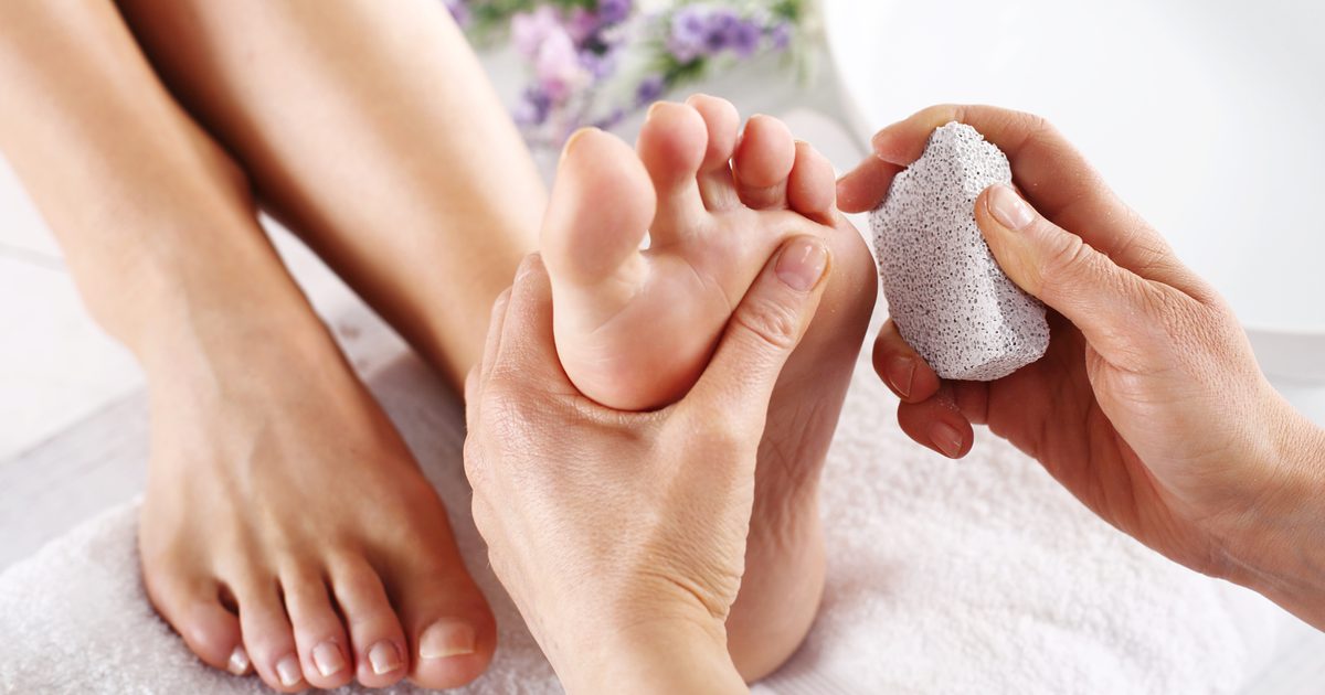 Peeling huid behandelen op voeten
