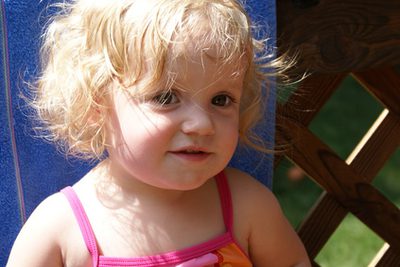 Kako zdraviti močno posušeno lasišče pri majhnih otrocih