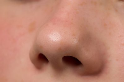 Ako odblokovať nos