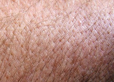 Пилинг кожи и грибковых инфекций кожи