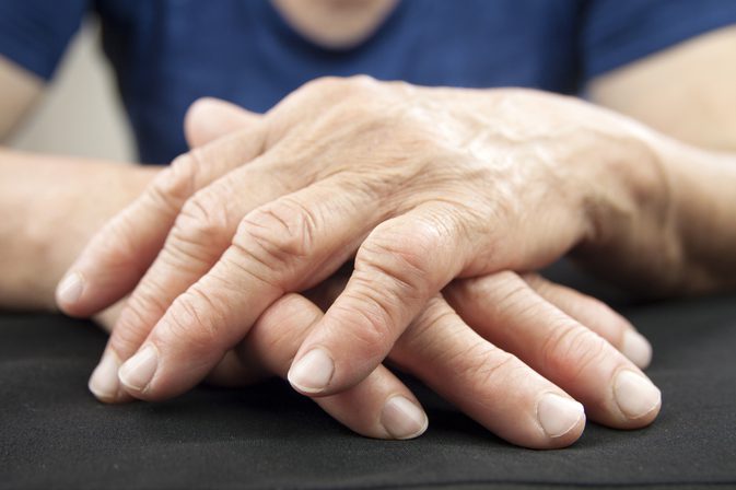 Príznaky reumatoidnej artritídy a kože