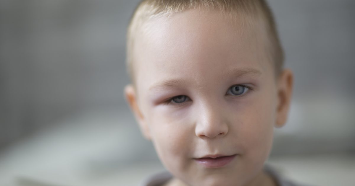 Et hævet øjenlåg i et barn