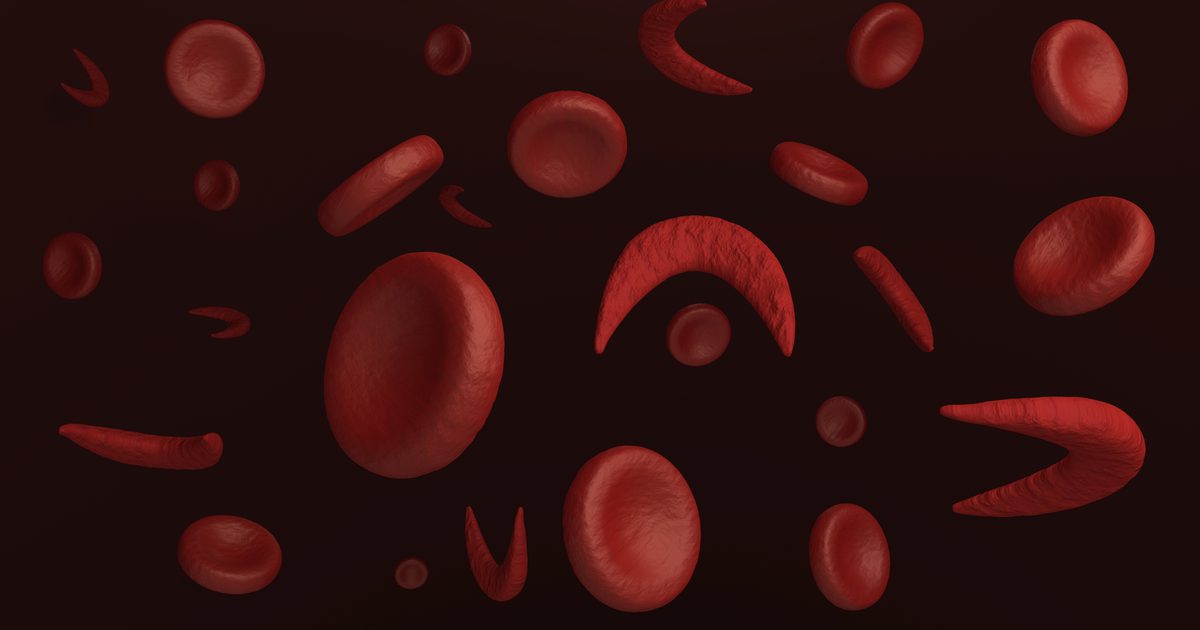 Systemer af kroppen påvirket af Sickle Cell Anemia