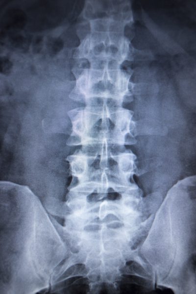Teeter Hang Ups Inverzné tabuľky pre bolesti chrbta
