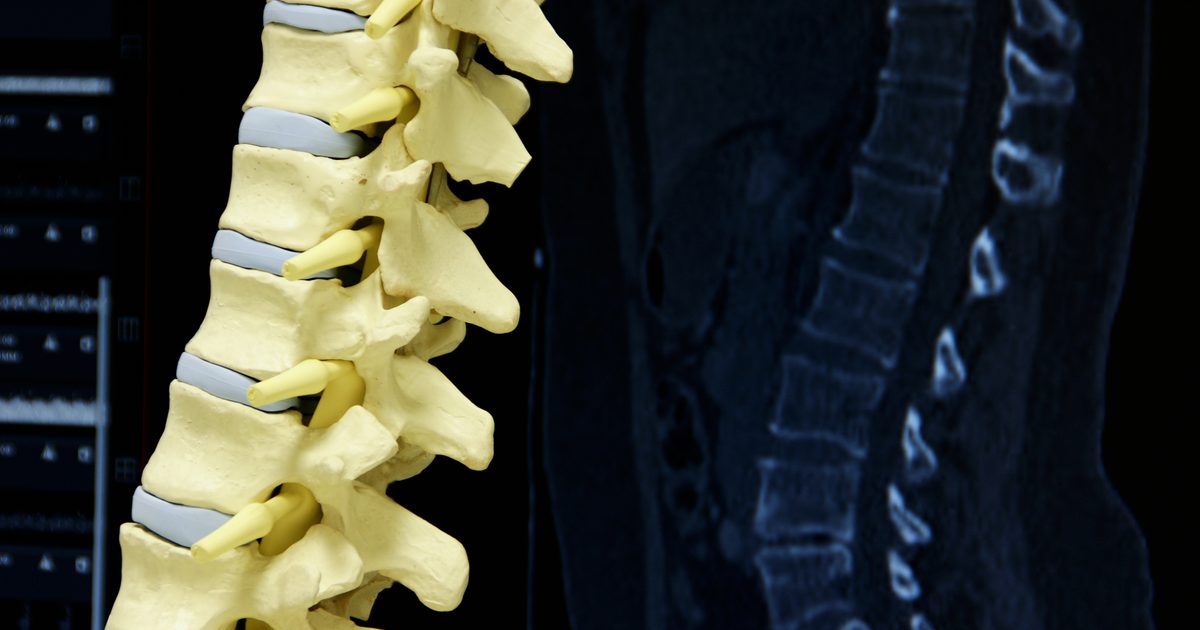Typy zadních ramen pro kompresní zlomeniny