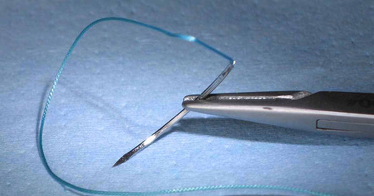 Soorten Chirurgische nietjes die intern worden gebruikt