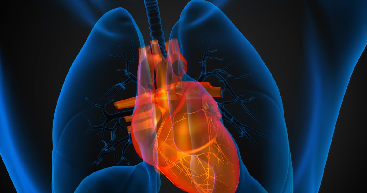 Was sind die Ursachen für eine vergrößerte Herzkammer?