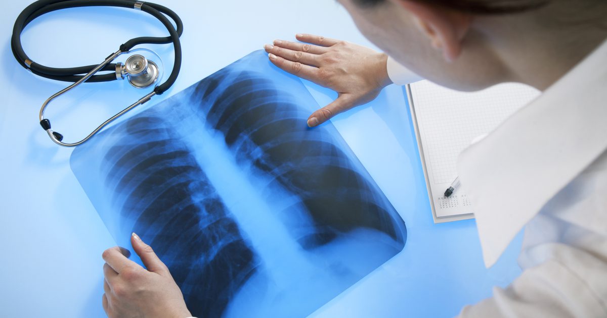 Vad är effekterna av tuberkulos på lungvävnad?