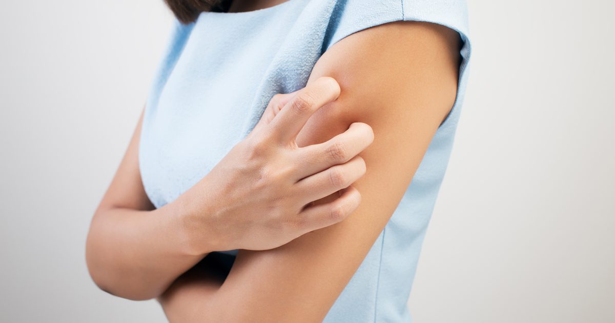 Kaj so kožni simptomi pršic?