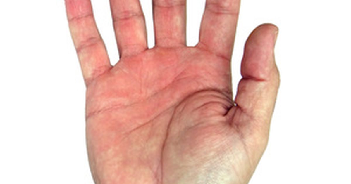 Hvad er symptomerne på nerveskade i håndleddet?