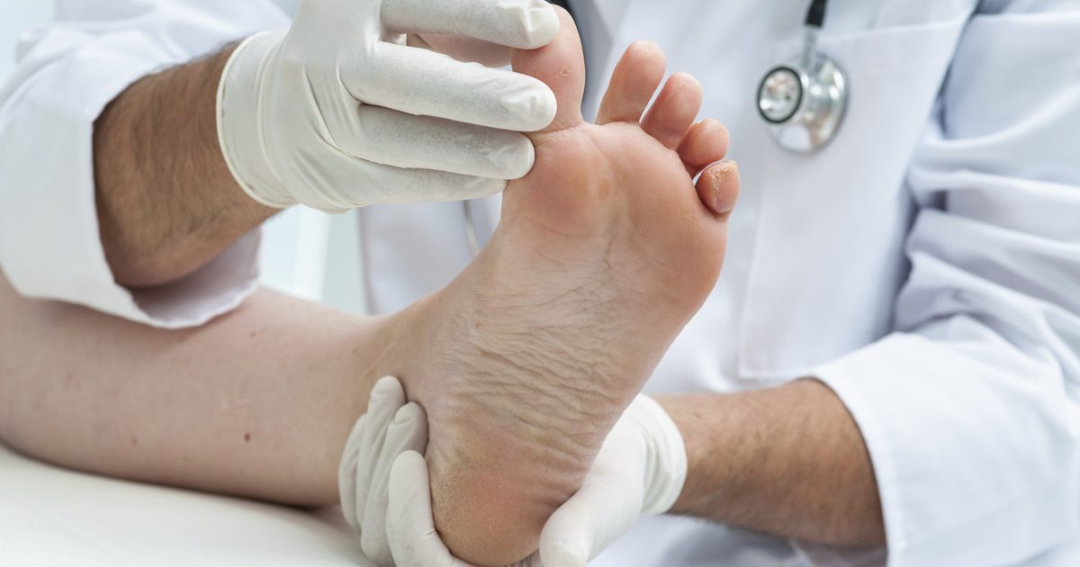 Kaj povzroča otrplost v prstih in nogah?