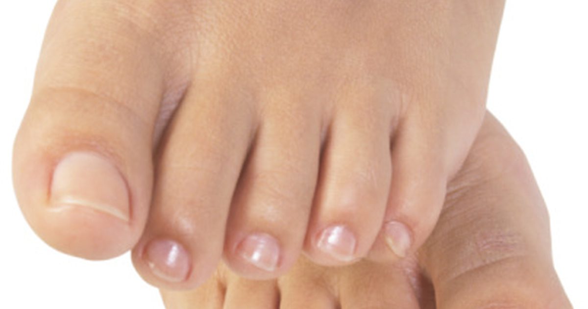 Vilka brister orsakar allvarliga tånkramper?
