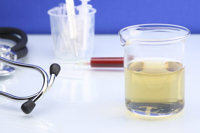 Vilka läkemedel testas för i en urinalys?