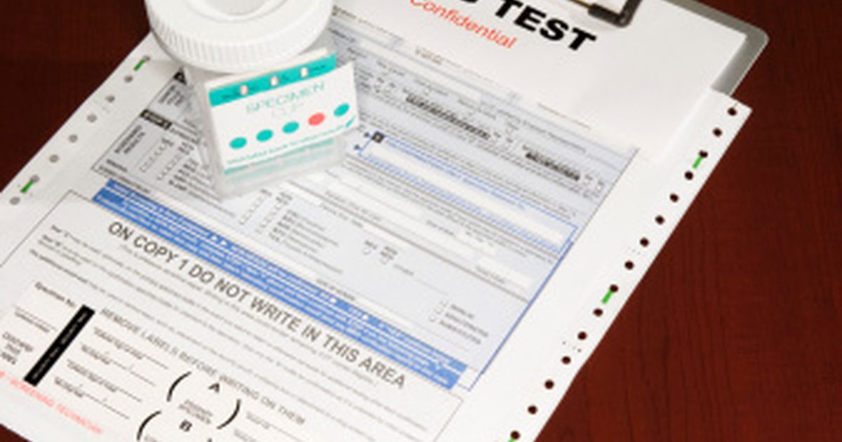 Co się stanie, jeśli nie zdasz testu na obecność narkotyków?