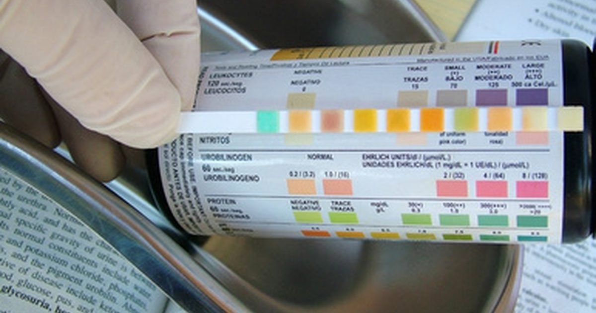 Kaj je normalno količina beljakovin v urinu?