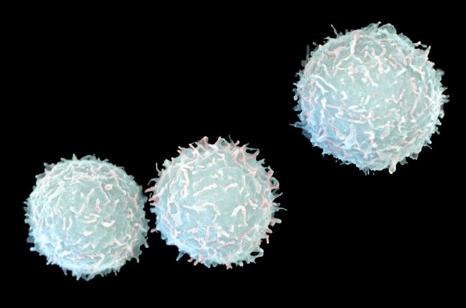 Welke soorten witte bloedcellen worden aangetroffen in een inflammatoir antwoord?