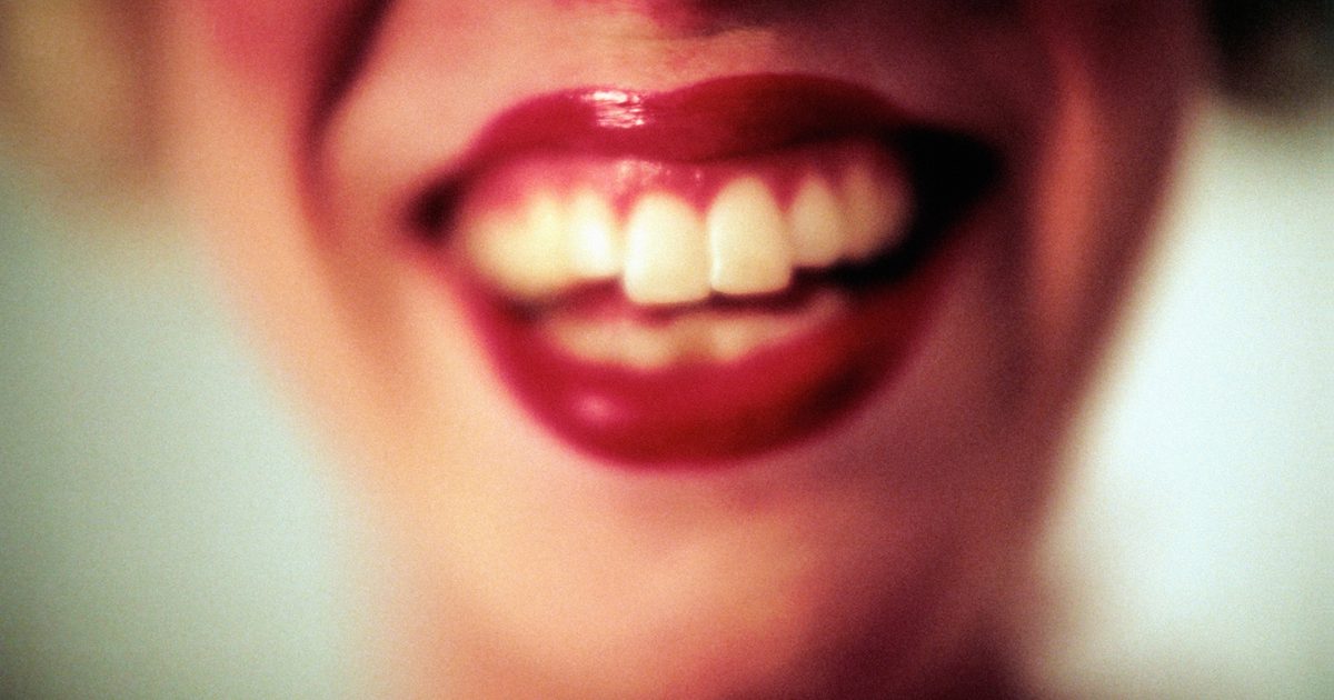 Vita blötningar på tänderna