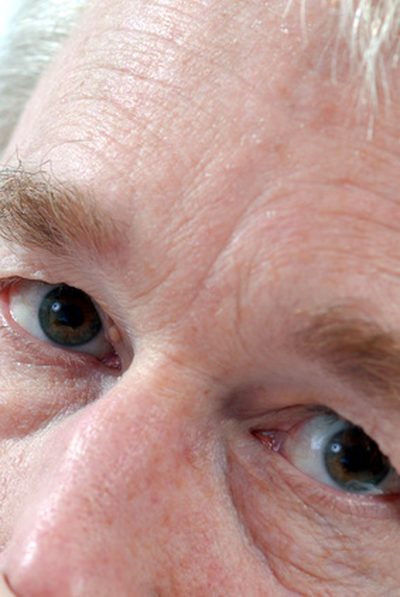 Najboljši očesni serumi, ki odstranijo vnetje