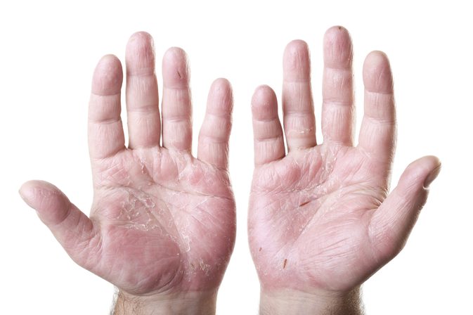 The Best Hand Lotion for tørre hender