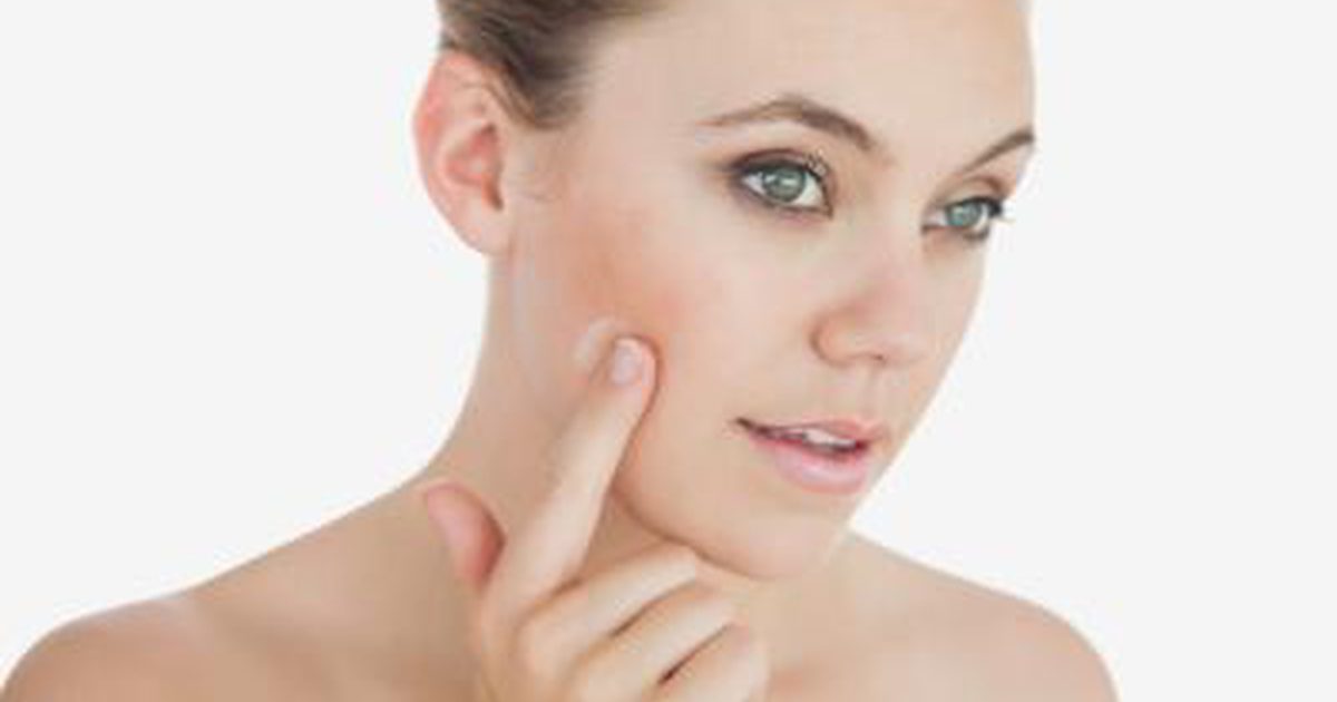 De beste organische huidverzorgingslijnen voor acne