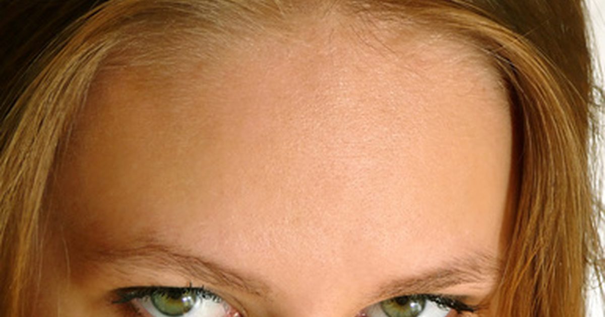 Botox Vs. Hautfüller für Stirnfalten