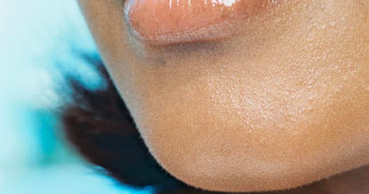Brun pigmentering på övre läppen