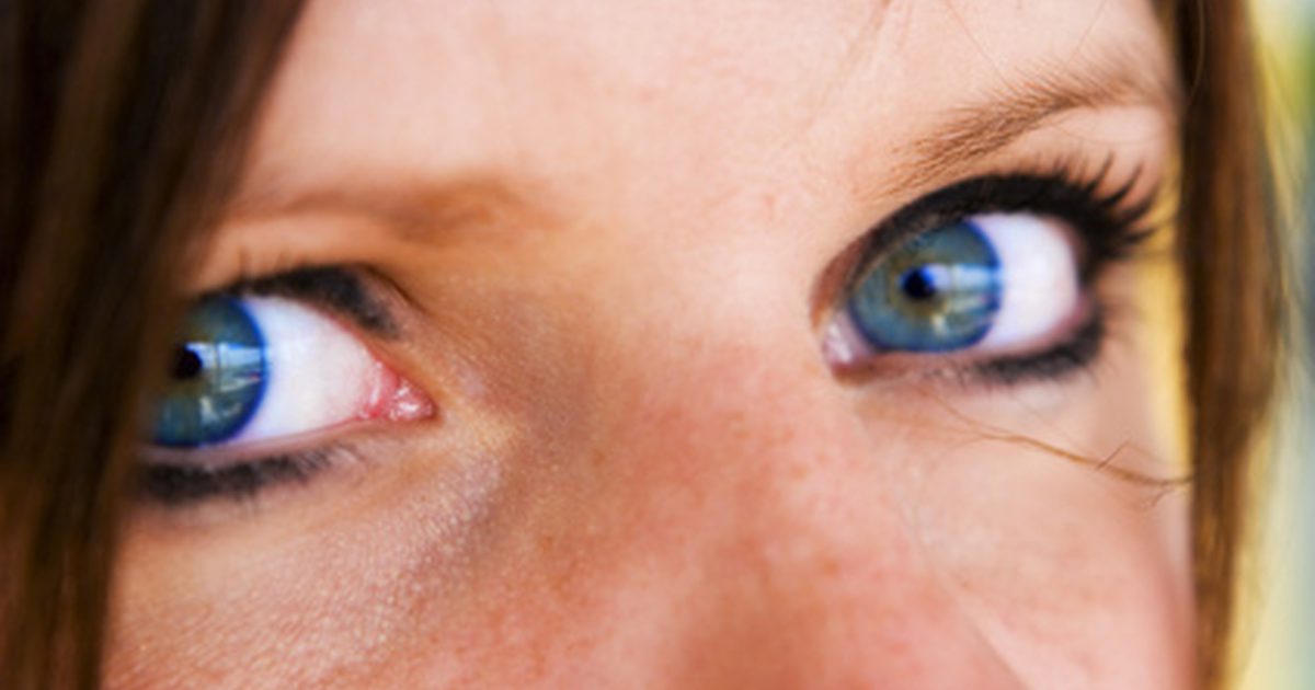 Können ernährungsbedingte Mängel dunkle Augenringe verursachen?