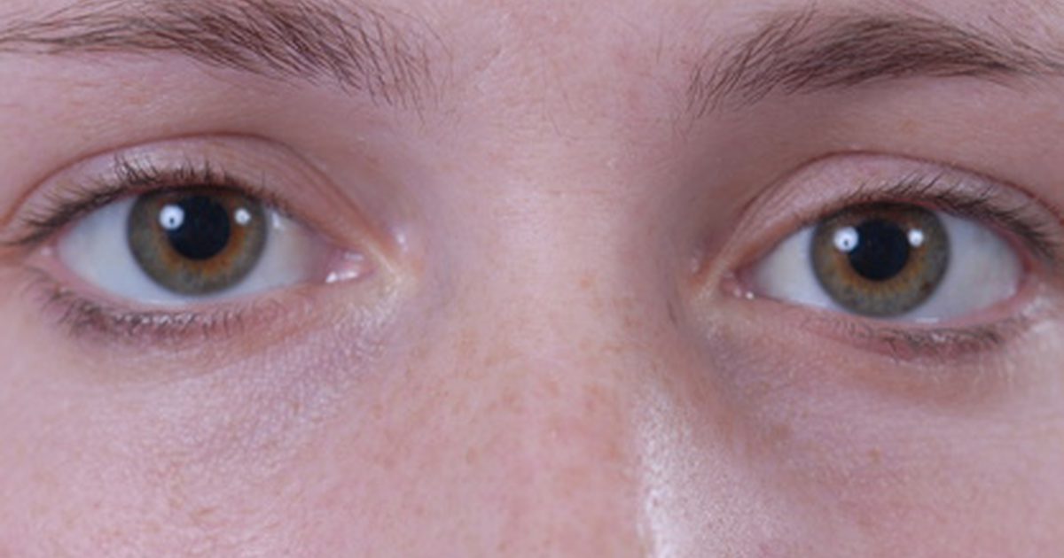 Можете ли вы использовать препарат H для темных глаз под глазами?