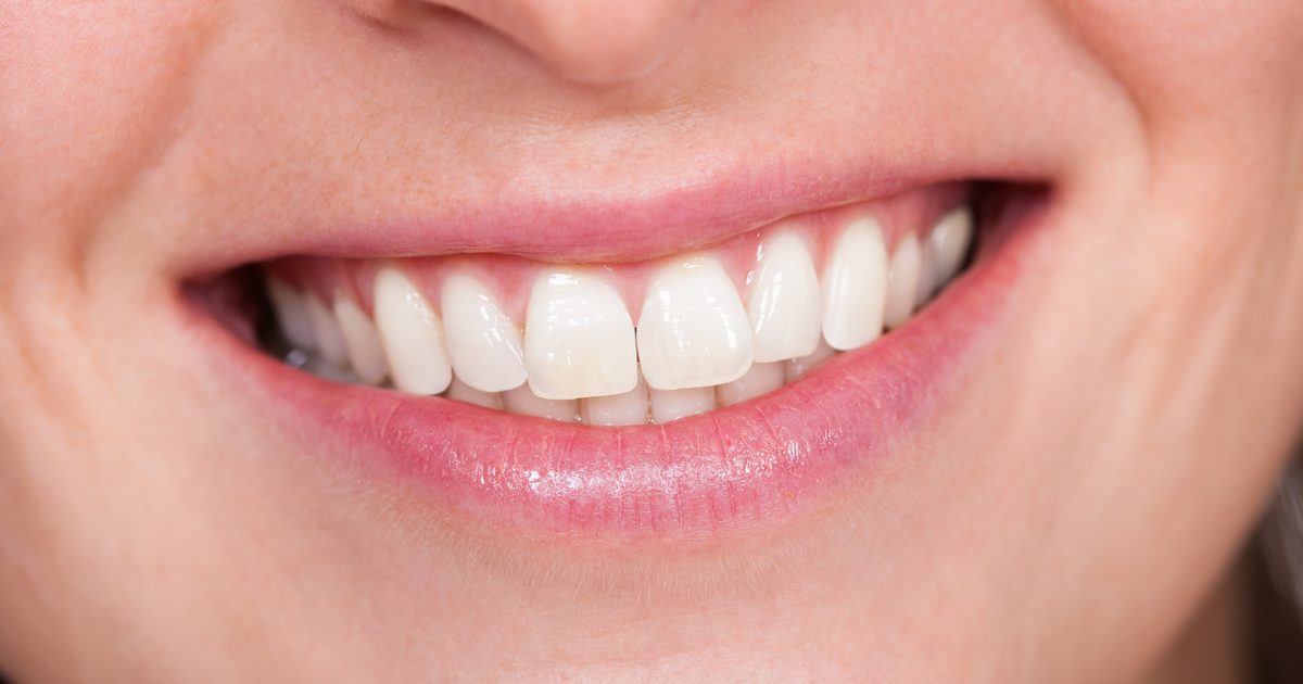 En jämförelse av tänder-Whitening Strips