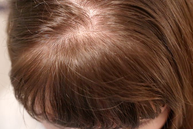Deep Conditioning för hår: Hem Remedies