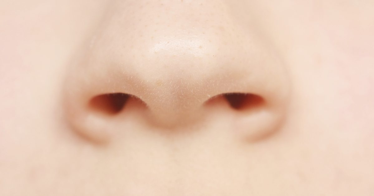Trockene schuppige Haut um Nase und Mundwinkel